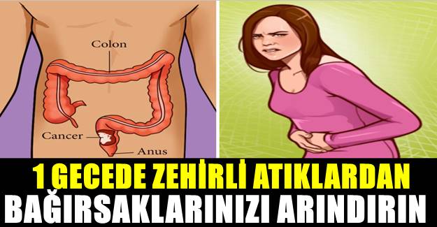 Starcraft 2: Boşluğun mirası - ilerlemenin ve oyunun kısa bir genel görünümü 63
