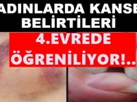 Kadınlarda En çok Görülen Kanser Türleri- Bakınız listede yer alan hastalıklarda neler var?