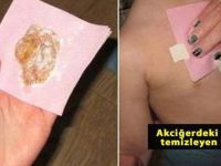 Akciğerlerinizden balgamı temizlemek için bu yöntemi kullanabilirsiniz! Tarife
